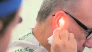 Ear Irrigation with a Propulse NG Ear Irrigatorwmv [upl. by Aligna966]