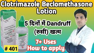 Candid B lotion  Candid B lotion for hair dandruff  Clotrimazole beclomethasone lotion [upl. by Chivers]