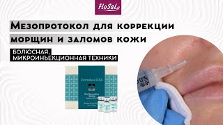 Мезопротокол для коррекции морщин и заломов кожи Dermaheal HSR [upl. by Gile]