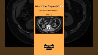 Whats Your Diagnosis 👀radiology ct ctscan abdomen doctor medicalstudent medicaltest [upl. by Carmel955]