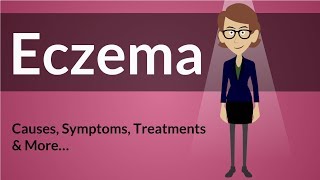 Eczema  Causes Symptoms Treatments amp More… [upl. by Inod]