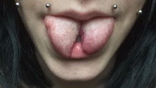 ◉ Tongue Split  Healing Process ◉ [upl. by Octavus]