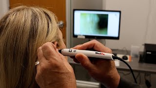 MedRx Video Otoscope Benefits [upl. by Anderegg604]