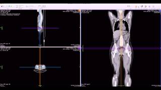 OsiriX Loading Speed [upl. by Sacul]