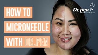 How to microneedle at home with Dr Pen  Dr Pen Australia  Microneedling  Skin Needling  CIT [upl. by Elizabeth]