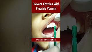 Prevent Cavities with Fluoride Varnish 🦷 cavities dental dentalshorts [upl. by Norvall]