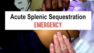 Sickle Cell Splenic Sequestration Emergency [upl. by Emiolhs]