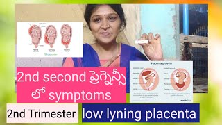 Low lyning placenta  placenta previa 2nd trimester in pregnancy viralvideo trending vlogs [upl. by Gambell13]