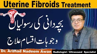 Uterine Fibroids CausesTypesSymptoms And Treatment [upl. by Neil]