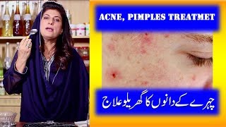 Acne Pimples Home Treatment with Aloe Vera by Dr Bilquis Shaikh [upl. by Ennayr]