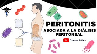 DIÁLISIS PERITONEAL Infección Diagnostico tratamiento y Prevención [upl. by Eetnuahs]