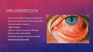 Conjunctivitis [upl. by Maureene976]