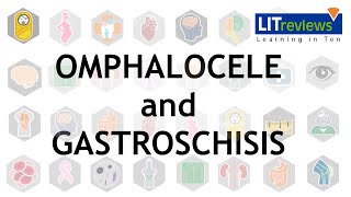 Omphalocele and Gastroschisis [upl. by Savanna]