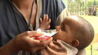 HealthPhone™ English  5 Appetite Testing Techniques  Management of Severe Acute Malnutrition [upl. by Aicela]