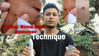 Mwkangni Sobai Bimakwo Mabwrwi Bwkarw Naidw  How to remove Black mole  Kokrajharian Vlogger [upl. by Lenni749]