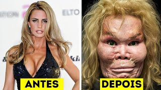 15 Desastres em Cirurgias Plásticas de Famosos [upl. by Alliw]