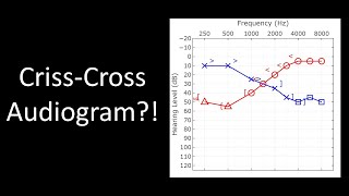 Dont get tricked by this audiogram Masking tutorial [upl. by Arrek]