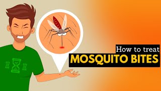 How To Treat Mosquito Bites [upl. by Akiam828]