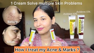 How to use Azelaic Acid correctly  Honest Review  All in One Cream [upl. by Ling244]