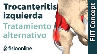 Trocanteritis izquierda  Visión desde la fisioterapia y la medicina natural [upl. by Ahsercul]