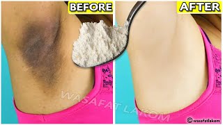 How To Get Rid Of Dark Armpits INSTANTLY 100 works [upl. by Ashly]