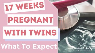 17 weeks pregnant twins to do list and what to expect [upl. by Lamraj]