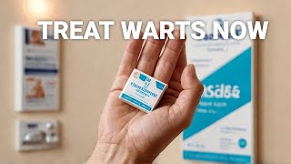 The Horrifying Types of Warts And How to Treat Them [upl. by Navonoj]