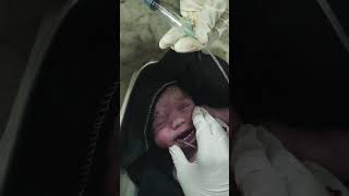 Normal delivery ke baad baby ke pet ki safaai kese kare viralclips cutebaby normal delivery [upl. by Anigroeg]