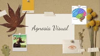 Agnosia Visual [upl. by Barbey]