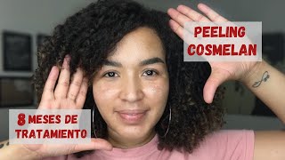 COSMELAN PEEL  ¡¡8 MESES DE TRATAMIENTO [upl. by Ylrebnik]