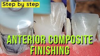 finishing anterior composite step by step [upl. by Waddell]