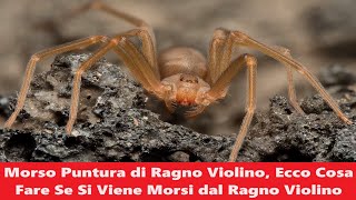 Morso Puntura di Ragno Violino Ecco Cosa Fare Se Si Viene Morsi dal Ragno Violino [upl. by Mable485]