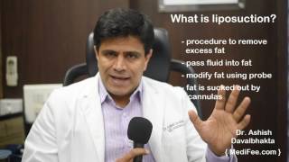 Liposuction Surgery Procedure and Cost in India [upl. by Christensen]