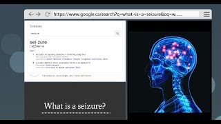 What Are Seizures and How to Recognize Them [upl. by Ulland]