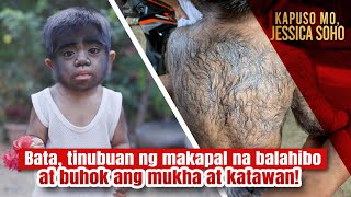 Bata tinubuan ng makapal na balahibo at buhok ang mukha at katawan  Kapuso Mo Jessica Soho [upl. by Cini]