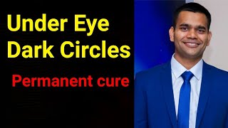 Permanent Cure Of Dark Circles under the eyes  Dr Vivek Joshi [upl. by Araminta]