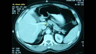 Cross sectional and imaging anatomy of the abdomen [upl. by Eiliah203]