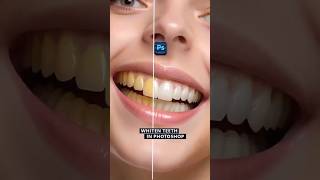 Whiten teeth in photoshop photoshoptutorial adobe graphicdesigntutorial shorts shortvideo [upl. by Topping149]