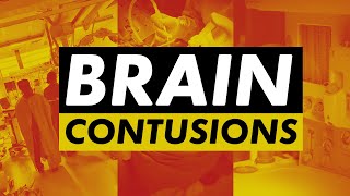 Contusion  traumatic brain injury explained [upl. by Ayotahs434]