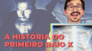 A HISTÓRIA DO PRIMEIRO RAIO X  VOGALIZANDO A HISTÓRIA [upl. by Demitria614]