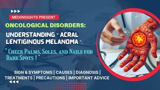 Understanding Acral Lentiginous Melanoma Symptoms Causes Diagnosis and Treatment  MediInsights [upl. by Iht34]