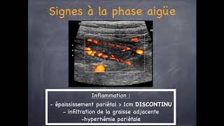 Maladies Inflammatoires Chroniques de lIntestin  2 Crohn amp Rectocolite Hémorragique [upl. by Odnumyar]