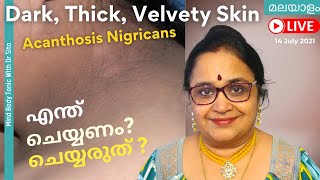 Acanthosis Nigricans  കറുത്ത നിറംപാടുകൾ  എന്തിനെ സൂചിപ്പിക്കുന്നു  മാറിപോകാൻ ചെയ്യേണ്ടത് [upl. by Gally]