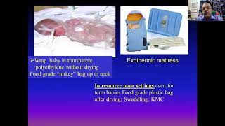 NRP in a nutshell  Neonatal Resuscitation Program [upl. by Teagan]