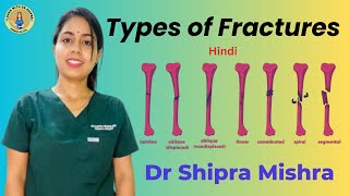 Types of Fractures in hindi  fracture treatment  bone Fracture Fracture types and mangment [upl. by Oswin]