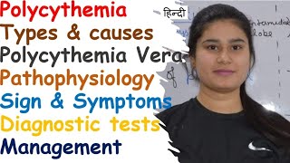 Polycythemia  Types  Pathophysiology  Sign amp Symptoms  Diagnose  Management [upl. by Patterman658]