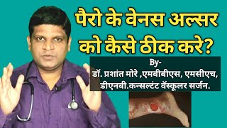 Foot Ulcer Treatment at home in Hindi Varicose Ulcer Treatment  Ulcer Treatment in Hindi [upl. by Terr]