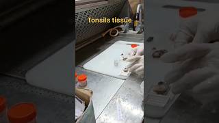 Tonsils tissue for histopathology [upl. by Burkhardt804]