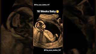 16 weeks Baby doctor babydoctor abdomen pregnant ultrasound babygirl babyboy babyshorts [upl. by Dianuj]