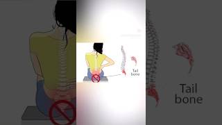 Coccydynia exercises coccydynia physio physiotherapy [upl. by Freida]